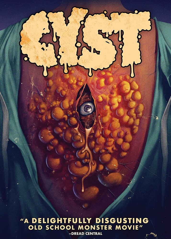 Cyst - Cyst / (Sub)