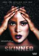 Skinned , Brad James