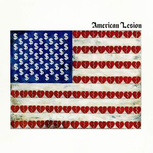 American Lesion (White Vinyl)