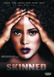 Skinned