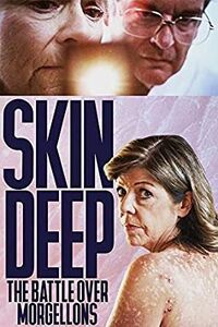 Skin Deep: The Battle Over Morgellons