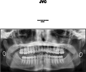 Jvc [Explicit Content]