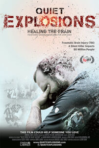 Quiet Explosions: Healing The Brain