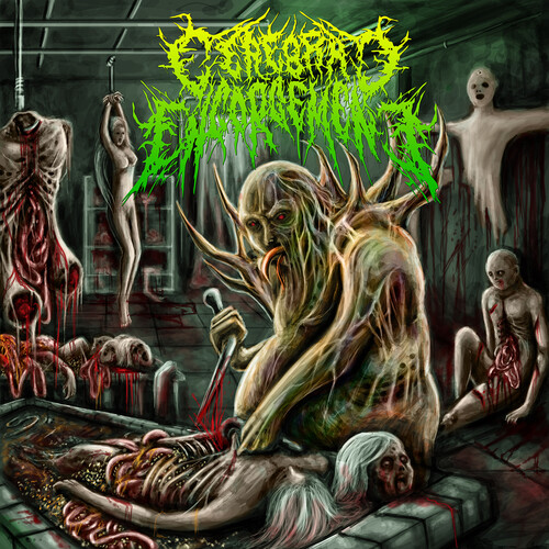 Midori - Gastrointestinal Bleeding