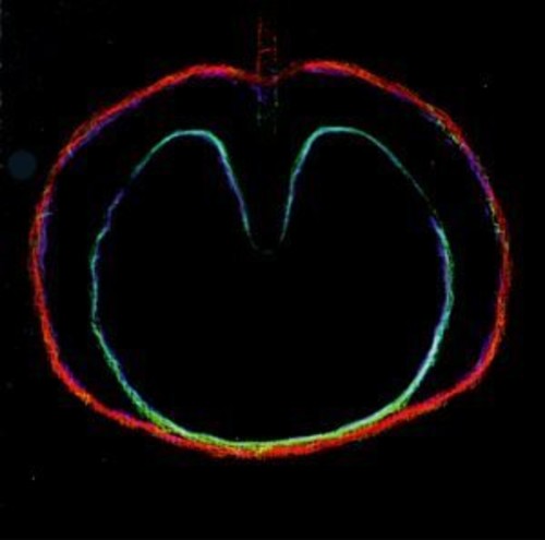 Wasp Star (Apple Venus Vol. II) [Import]