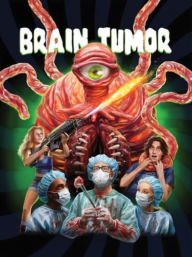Brain Tumor - Brain Tumor