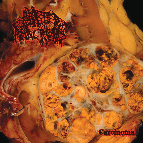 Blasted Pancreas - Carcinoma [Colored Vinyl] [Limited Edition] (Red)