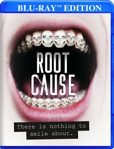 Root Cause