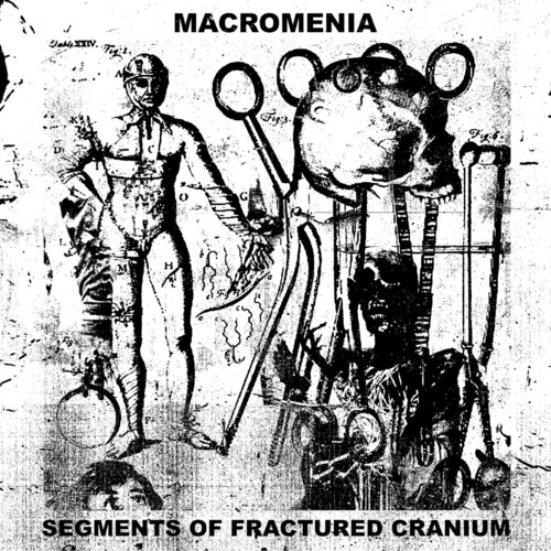 Segments Of Fractured Cranium
