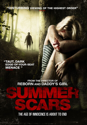 Summer Scars