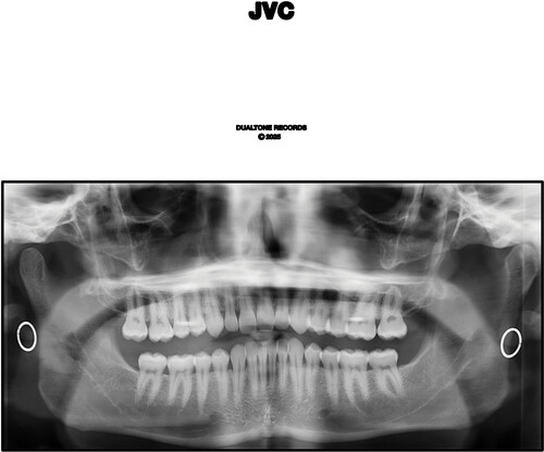 Jvc [Explicit Content]