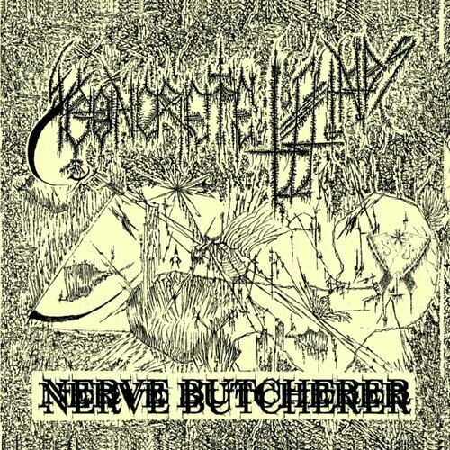 Nerve Butcherer